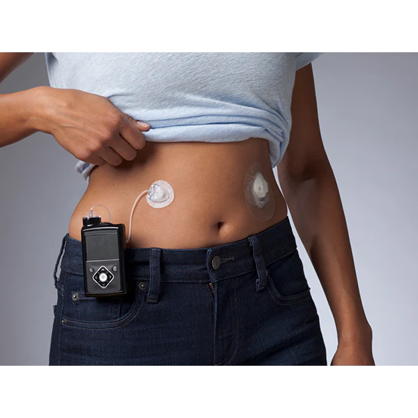 Medtronic Mio Advance Infusion Set, Clear, 9mm cannula with 23